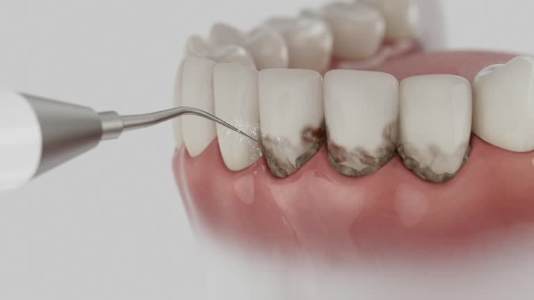 Trusted Root Canal Treatment service in Beverly Hills, FL - Dentist Open Now